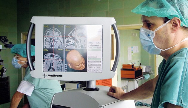 Poruchy řeči i ochrnutí. Nemocnice poradí, jak rozpoznat příchod mrtvice