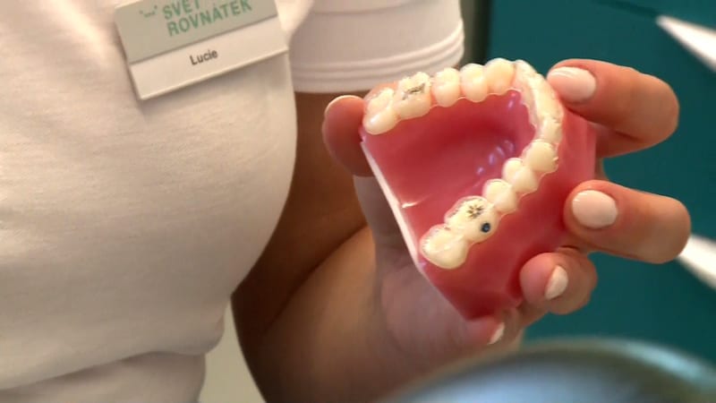 Rovnátka za pár desítek korun z e-shopu? Skalpelem se taky sami neoperujete, varují lékaři