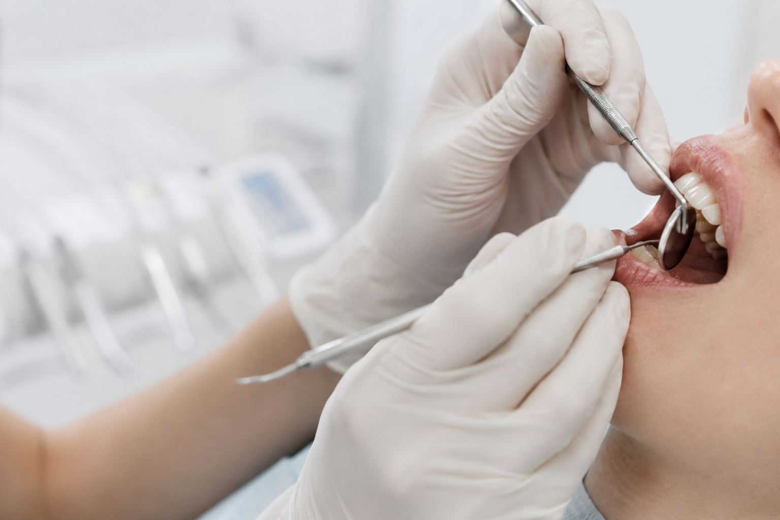 Dentální hygiena: malý krok pro zdravý úsměv, velký krok pro vaše zuby